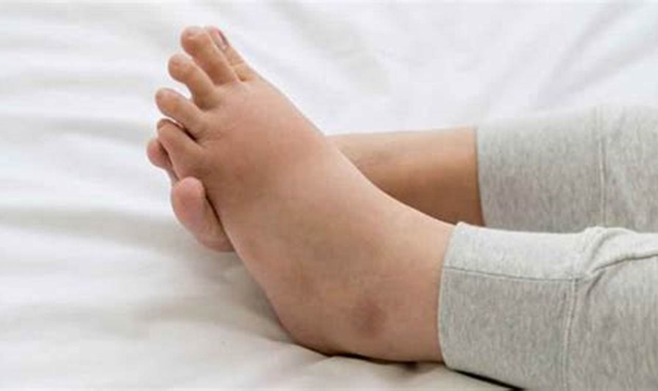 cara mengatasi kaki bengkak setelah melahirkan